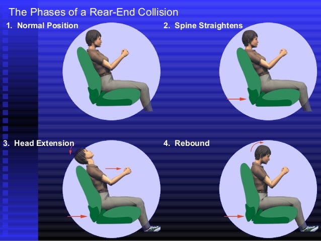 Rear Impact Neck Injury