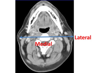 Lateral
Medial
 