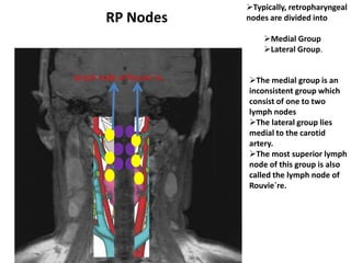 Typically, retropharyngeal
nodes are divided into
Medial Group
Lateral Group.
The medial group is an
inconsistent grou...
