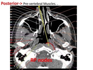 Posterior-> Pre-vertebral Muscles. .
RP nodes
 