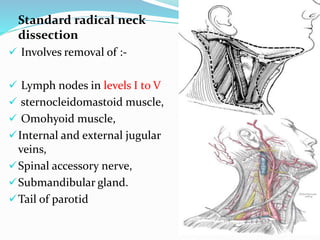 Standard radical neck
dissection
 Involves removal of :-
 Lymph nodes in levels I to V
 sternocleidomastoid muscle,
 Omohyoid muscle,
Internal and external jugular
veins,
Spinal accessory nerve,
Submandibular gland.
Tail of parotid
 