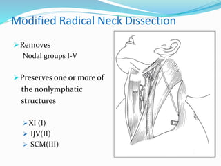 Modified Radical Neck Dissection
Removes
Nodal groups I-V
Preserves one or more of
the nonlymphatic
structures
 XI (I)
 IJV(II)
 SCM(III)
 