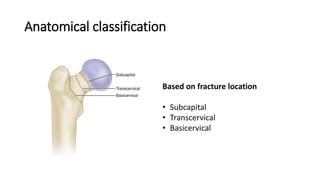NECK OF FEMUR FRACTURE ORTHOPAEDICS.pptx