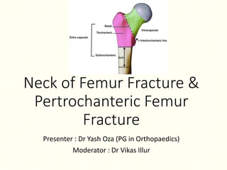 Neck of Femur Fracture &
Pertrochanteric Femur
Fracture
Presenter : Dr Yash Oza (PG in Orthopaedics)
Moderator : Dr Vikas Illur
 