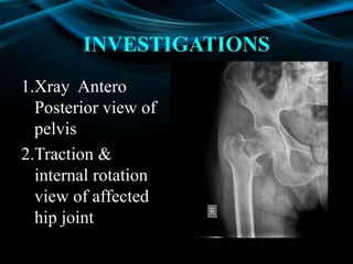 Traction Internal Rotation View Neck of femur fracture in adults ju | PPTX