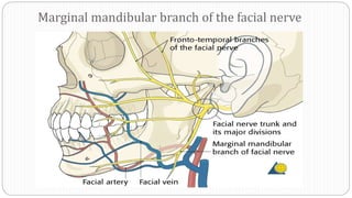 Marginal mandibular branch of the facial nerve
 