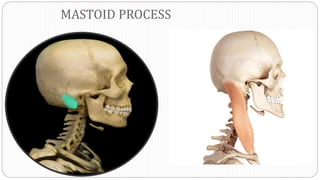 MASTOID PROCESS
 