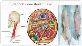Sternocleidomastoid muscle
 