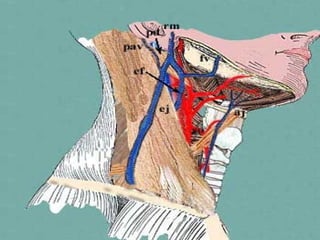 Carotid triangle
• Vein of the carotid triangle




  Vein of the carotid triangle
 