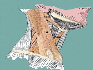 Boundaries of Carotid Triangle
 