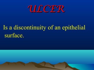 ULCER
Is a discontinuity of an epithelial
 surface.
 
