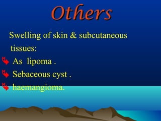 Others
 Swelling of skin & subcutaneous
 tissues:
 As lipoma .
 Sebaceous cyst .
 haemangioma.
 