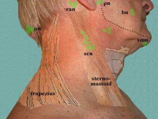 Neck swelling