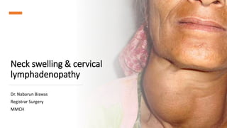 Neck swelling & cervical
lymphadenopathy
Dr. Nabarun Biswas
Registrar Surgery
MMCH
 