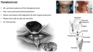 Thyroglossal cyst:
• AE: persistant patency of the thyroglossal duct
• Site: most commonly below hyoid bone
• Moves up & down with deglutition & with tongue protrusion.
• Moves from side to side not vertically
• ttt: Sistrunk Op.
 