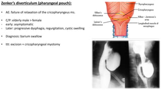 Zenker’s diverticulum (pharyngeal pouch):
• AE: failure of relaxation of the cricopharyngeus ms.
• C/P: elderly male > female
- early: asymptomatic
- Later: progressive dysphagia, regurgitation, cystic swelling
• Diagnosis: barium swallow
• ttt: excision + cricopharyngeal myotomy
 