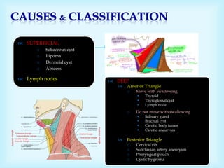  SUPERFICIAL
o Sebaceous cyst
o Lipoma
o Dermoid cyst
o Abscess
 Lymph nodes  DEEP
 Anterior Triangle
o Move with swallowing
 Thyroid
 Thyroglossal cyst
 Lymph node
o Do not move with swallowing
 Salivary gland
 Brachial cyst
 Carotid body tumor
 Carotid aneurysm
 Posterior Triangle
o Cervical rib
o Subclavian artery aneurysm
o Pharyngeal pouch
o Cystic hygroma
 