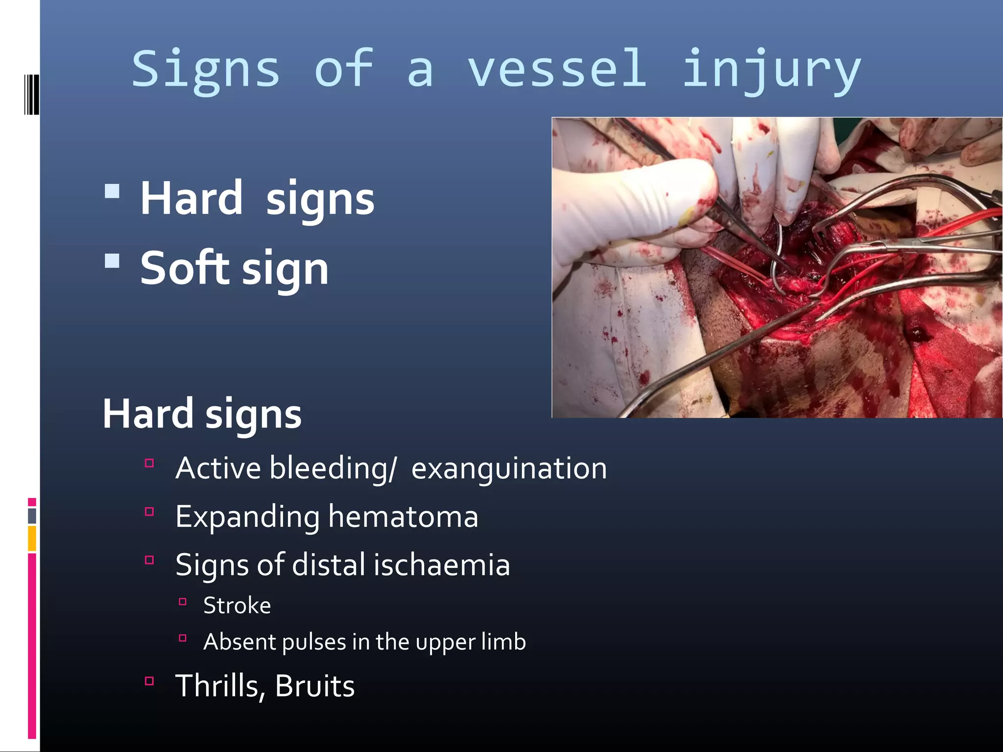 VASCULAR INJURIES OF THE NECK PRE CONGRESS WORKSHOP ACS JOEL ...