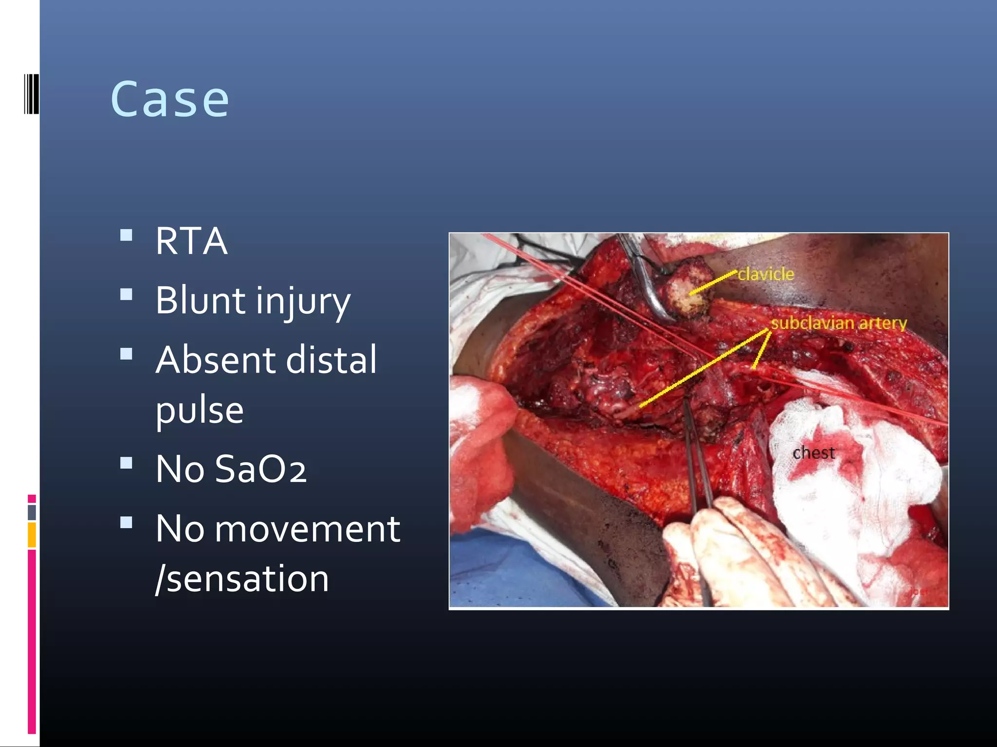 VASCULAR INJURIES OF THE NECK PRE CONGRESS WORKSHOP ACS JOEL ...
