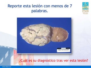 ¿Cuál es su diagnóstico tras ver esta lesión?
Reporte esta lesión con menos de 7
palabras.
 