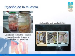 Fijación de la muestra
Cada cajita será una laminilla.
La relación formalina – órganos
es muy importante para la
calidad de las laminillas.
 