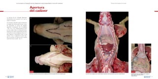 La necropsia en el ganado porcino, diagnóstico anatomopatológico y toma de muestras

Técnica de necropsia en el cerdo

Apertura
del cadáver
La apertura de las cavidades dependerá
directamente de la posición en la cual se
realice la necropsia.

A

En animales en decúbito supino, inicialmente
se realizan dos cortes sobre la piel y el tejido subcutáneo en forma de triángulo
siguiendo la proyección de la mandíbula
–Figs. 11A y 11B–. Posteriormente, se realiza una incisión hasta la entrada del tórax,
donde con el mismo instrumento de corte,
se secciona la zona cartilaginosa de las costillas dejando al descubierto toda la caja
torácica –Fig. 12–. Siguiendo el corte, también se procede a la apertura de la cavidad
abdominal hasta el pubis –Fig. 13–.

B

Fig. 11
Marca (A) y corte (B) de la piel que cubre la mandíbula en caso de una necropsia del animal en decúbito supino.
20

Fig. 12
Corte de la zona cartilaginosa de las costillas dejando al descubierto toda la caja torácica y parte de la cavidad abdominal.

Fig. 13
Finalización del mismo corte, llegando hasta la región del
pubis y dejando al descubierto toda la
cavidad abdominal.
21

 