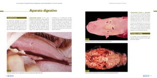 La necropsia en el ganado porcino, diagnóstico anatomopatológico y toma de muestras

Evaluación macroscópica de vísceras

Aparato digestivo
Cavidad bucal
Las alteraciones patológicas en la cavidad
bucal son poco frecuentes en el cerdo. El
grupo más importante de estas lesiones es
el de las inflamaciones de la mucosa bucal
(estomatitis) y encías (gingivitis). En la cavidad bucal se describen básicamente dos
tipos de inflamación en el ganado porcino:

• Estomatitis vesicular –Fig. 105–: caracterizada por la presencia de zonas pálidas en
la mucosa bucal, que tienden a hacer un ligero relieve hasta que finalmente se produce
una formación vesicular. El mecanismo patogénico de esta alteración consiste en una
separación de las capas superficiales del epitelio respecto al estrato basal (se mantiene
intacto si no existen infecciones bacterianas

• Estomatitis

erosiva o ulcerativa
–Fig. 106–: consiste en la presencia de úlceras o erosiones en la mucosa bucal. Puede
provenir de la evolución de una estomatitis
vesicular o bien tener un origen traumático,
metabólico (casos de uremias muy elevadas: estomatitis urémica) o de otra índole.

secundarias, y en 1-2 semanas hay una regeneración total del epitelio).Debido a que estas
vesículas se suelen situar en zonas de estrés
mecánico, se pueden romper dejando a la
vista una erosión de color rojizo. La estomatitis vesicular se suele asociar a infecciones víricas tales como la fiebre aftosa o glosopeda,
estomatitis vesicular, exantema vesicular, enfermedad vesicular, etc.

De entre las inflamaciones de la encía en el
ganado porcino, las gingivitis necrotizantes
–Fig. 107– son las más frecuentes. Se suelen
asociar a un corte de muelas mal realizado,
con posterior invasión bacteriana de la zona
afectada, la cual finalmente se necrosa.

Faringe y esófago

Fig. 106

En el ganado porcino normalmente no se
describen lesiones asociadas en esta región
del aparato digestivo.

Estomatitis erosivo-ulcerativa en la superficie lingual dorsal asociada a fiebre aftosa.

Fig. 105
Presencia de una pequeña vesícula en la lengua (flecha) en un caso de estomatitis vesicular debida a fiebre aftosa.
64

Fig. 107
Presencia de fibrina y material necrótico en la encía y en la cavidad bucal (gingivitis fibrino-necrotizante).
65

 