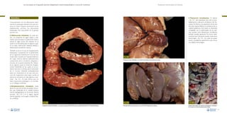 La necropsia en el ganado porcino, diagnóstico anatomopatológico y toma de muestras

Evaluación macroscópica de vísceras

• Trastornos

Intestino

circulatorios. El edema
–Fig. 124– del mesenterio del colon es probablemente la alteración circulatoria más frecuente. Se observa una separación de las asas
del colon espiral debido a la presencia de un
material gelatinoso. Esta lesión es altamente
compatible con la enfermedad de los edemas, aunque otras alteraciones circulatorias
también pueden generarla. De forma relativamente poco frecuente pueden observarse
hemorragias –Fig. 125–, las cuales se suelen
asociar a problemas septicémicos que cursan
con diátesis hemorrágica.

Conjuntamente con las alteraciones respiratorias, la patología intestinal es la que ocasiona un mayor impacto económico en las
explotaciones porcinas. Las alteraciones
intestinales más importantes en el ganado
porcino son:

• Obstrucción intestinal. Se suele asociar a la presencia de algún objeto o elemento que provoque la obstrucción total o
parcial en algún punto del intestino. En el
cerdo no es frecuente, pero en algunos casos
se ha dado obstrucción intestinal debida a
infestaciones parasitarias masivas.

También se da en el caso de invaginaciones
intestinales, consistentes en la penetración
de un segmento intestinal en la luz de otro
(suele estar causado por hiperperistaltismo
de origen diverso, diarrea habitualmente),
compromiso de la circulación sanguínea y
necrosis de la pared intestinal. No obstante, en algunos casos, se observan invaginaciones intestinales en las cuales no se evidencia necrosis ni cambios de la coloración
de la mucosa intestinal; probablemente
éstas son situaciones en las que este proceso de invaginación tiene lugar cuando el
animal se encuentra en fase agónica o terminal –Fig. 122–. En este último caso no
tiene importancia patológica y se considera un hallazgo incidental.

Fig. 123
Presencia de asas intestinales en el interior de la bolsa escrotal (hernia escrotal).

•

Desplazamiento intestinal. Suele
darse en caso de hernias. Se pueden encontrar asas intestinales en la cavidad torácica
(hernia diafragmática), en el escroto (hernia
escrotal –Fig. 123–), en la región inguinal
(hernia inguinal) y en la región umbilical (hernia umbilical).
Fig. 122
Invaginación intestinal atribuible a un proceso de agonía (ausencia de lesiones orgánicas aparentes en el intestino afectado).
72

Fig. 124
Marcado edema de mesocolon en un caso de enfermedad de los edemas.

Fig. 125
Diátesis hemorrágica con presencia de petequias y sufusiones
en el colon en un caso de peste porcina clásica.
73

 