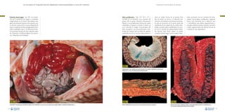 La necropsia en el ganado porcino, diagnóstico anatomopatológico y toma de muestras

Enteritis hemorrágica –Fig. 128–: se caracteriza por la presencia de sangre o contenido
sanguinolento en el interior del intestino delgado,aumentando el grosor de la pared,y por
la necrosis masiva de la mucosa intestinal. Se
asocia a bacterias de alta patogenicidad (Clostridium perfringens tipo C en lechones durante la primera semana de vida y algunas cepas
de Escherichia coli β-hemolíticas que provocan colibacilosis post-destete).

Evaluación macroscópica de vísceras

Ileítis proliferativa –Figs. 129, 130 y 131–:
consiste en un aumento muy marcado del
grosor de la pared intestinal, básicamente
debido a una proliferación intensa de criptas
intestinales inmaduras. Cuando la lesión es
muy marcada, la imagen macroscópica del
íleon recuerda a las circunvoluciones cerebrales, de manera que se habla de aspecto
cerebriforme de la mucosa (este aspecto a

veces es visible incluso en la serosa). Este
tipo de lesión se asocia a la infección por
Lawsonia intracellularis, una bacteria intracelular que se encuentra en la parte apical del
citoplasma de las células de las criptas intestinales. La lesión básica proliferativa se conoce con el nombre de adenomatosis intestinal porcina. Esta forma básica se puede
complicar dando lugar a otros cuadros lesio-

nales conocidos con los nombres de: enteropatía hemorrágica proliferativa (segunda
forma más frecuente de la infección por
L. intracellularis, que afecta especialmente a
animales adultos jóvenes), enteritis necrótica
e ileítis regional. Estas dos últimas formas se
consideran muy esporádicas.

Fig. 129
Engrosamiento muy evidente de la pared del íleon con aspecto cerebriforme de la serosa
intestinal en un caso de adenomatosis intestinal porcina.

Fig. 128
Coloración marcadamente enrojecida de algunas asas intestinales en el caso de una enteritis hemorrágica debida a Clostridium perfringens tipo C.
76

Fig. 130
Áreas multifocales de necrosis de la mucosa del íleon (enteritis necrótica).

Fig. 131
Presencia de un gran coágulo de sangre y hemorragia difusa del íleon con engrosamiento
de su pared (enteropatía proliferativa hemorrágica).
77

 