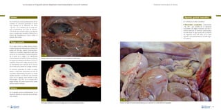 La necropsia en el ganado porcino, diagnóstico anatomopatológico y toma de muestras

Evaluación macroscópica de vísceras

Uréter

Aparato genital masculino

En el cerdo son raras las alteraciones de los
uréteres. En términos generales, la lesión
más habitual es la dilatación de éstos
–Fig. 183–, uni o bilateral, que se suele asociar a hidronefrosis (en caso de obstrucción de las vías urinarias bajas), y en algunos
casos, a epidermitis exudativa (efecto de la
toxina de Staphylococcus hyicus sobre el
epitelio del uréter).

En el testículo se debe considerar:

• Anomalías

congénitas. Criptorquidia
–Fig. 185–, que consiste en un descenso
incompleto (no llega al escroto) de uno o
ambos testículos. El testículo criptorquídeo
se suele situar en algún punto de su trayecto
de migración: cerca del riñón, en el canal
inguinal o subcutáneamente en el anillo inguinal externo.

Vejiga urinaria
En la vejiga urinaria se debe destacar básicamente el grupo de inflamaciones (cistitis). Esta
puede ser del tipo catarral (macroscópicamente no se pueden diagnosticar, dado que
cursa con un incremento muy leve del grosor
de la pared de la vejiga o sin alteraciones
macroscópicas), purulenta o fibrino-purulenta
(se observa la presencia de fibrina y pus en la
superficie interna de la vejiga urinaria), e incluso necrotizante (con necrosis de la mucosa
y/o el resto de la pared de la vejiga urinaria).

Fig. 183
Dilatación bilateral de los uréteres (flechas) en un caso de epidermitis exudativa aguda.

En términos generales, las cistitis se suelen
asociar a infecciones bacterianas. Se trata de
una lesión relativamente frecuente en cerdas
adultas, asociada a la infección por Actinobaculum suis. En algunos casos también se dan
hemorragias –Fig. 184– en la mucosa de la
vejiga urinaria, tal como ocurre en la peste
porcina clásica y africana.

Uretra
En el ganado porcino prácticamente no se
observan lesiones en esta estructura del aparato urinario.
Fig. 184
Hemorragias multifocales en la mucosa de la vejiga urinaria en un caso de peste porcina clásica.
104

Fig. 185
Descenso incompleto del testículo izquierdo (flecha), que se ha mantenido en la cavidad abdominal (criptorquidia).
105

 