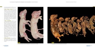 La necropsia en el ganado porcino, diagnóstico anatomopatológico y toma de muestras

Evaluación macroscópica de vísceras

En las hembras gestantes, las alteraciones que
se suelen observar en caso de aborto son:

•

Fetos nacidos muertos. Son fetos
prematuros –Fig. 190– o bien desarrollados
a término (con las mismas características que
un cerdo recién nacido normal). No obstante, se comprueba que han nacido muertos
porque no presentan aire en el interior de
los alvéolos (visible mediante la prueba de
flotación: no flotan en agua). Se asocia a causas genéticas, enfermedades víricas y bacterianas, manejo, etc. La inexistencia de lesiones
macroscópicas implica que el diagnóstico
debe establecerse en base a parámetros clínicos o laboratoriales.

•

Fetos momificados –Fig. 191–. La
momificación fetal es un proceso que puede
darse a partir de los 35 días de la gestación.
Además, un prerrequisito para que se produzca la momificación es que no tenga lugar
una infección bacteriana. Consiste en una
reabsorción de los fluidos fetales, llegando a
una deshidratación total, de manera que
todas las membranas quedan adheridas al
esqueleto y a los órganos desecados. El feto
pasa a adquirir un color marronáceo, con
mucus en su superficie, pero sin olor ni presencia de exudados. Se asocia a infecciones
víricas (siendo la parvovirosis porcina la
infección vírica causante de momificación
fetal más frecuente), número de partos de la
cerda (más frecuentes en las primerizas),
gestación de un número elevado de fetos y
micotoxicosis (intoxicación por zearalenona,
especialmente).

•

Fetos macerados. Sería equivalente al
caso anterior pero con la presencia de infección bacteriana, concomitante con inflamación del útero (metritis). Suelen producir muy
mal olor.
Fig. 190
Fetos prematuros abortados en el último tercio de gestación en un caso de infección por el virus del PRRS.
108

Fig. 191
Fetos momificados a causa de una infección intrauterina por parvovirus porcino.
109

 