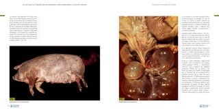 La necropsia en el ganado porcino, diagnóstico anatomopatológico y toma de muestras

Evaluación macroscópica de vísceras

En los ovarios no se suelen presentar alteraciones patológicas remarcables. En caso de
ovarios no cíclicos se puede observar su
superficie prácticamente lisa, con solamente
pequeños folículos y ausencia manifiesta de
cuerpos amarillos, rojos y blancos. Esta
misma imagen también correspondería a
animales prepúberes.

Las lesiones más habituales en el útero de la
cerda son las inflamaciones: metritis purulenta, que se caracteriza por la presencia de pus
en la superficie de la mucosa uterina, y metritis fibrinosa o fibrino-necrotizante, caracterizada por la presencia de exudado inflamatorio
purulento y focos de necrosis en la pared del
útero. Estas lesiones se asocian a infecciones
bacterianas, y se incluirían en el llamado síndrome de la cerda sucia. No obstante, de
forma ocasional, se pueden observar lesiones
no inflamatorias que afectan al útero como el
prolapso uterino –Fig. 192–.

También existen quistes ováricos –Fig. 193–,
que son una causa importante de infertilidad en la cerda. Se asume que se trata de
folículos maduros que no ovulan, y que pueden llegar a tener hasta 2-3 cm de diámetro.
Muchas veces, estos quistes ováricos son
concomitantes con quistes luteínicos.
En la glándula mamaria deben destacarse
especialmente las inflamaciones, y concretamente la mastitis granulomatosa crónica
(que consiste en la presencia de granulomas
y pus en la glándula mamaria y se suele asociar a infecciones bacterianas).
Existe un cuadro patológico antiguamente
conocido como el síndrome de mamitismetritis-agalaxia (MMA), y actualmente
conocido como síndrome de disgalaxia
post-parto (PPDS), que se asocia a una
forma purulenta de mamitis caracterizada
por un aumento de la consistencia de la
glándula mamaria que se suele dar poco
después del parto (12-48 horas post-parto).
Este proceso se asocia a infecciones por
bacterias coliformes (Escherichia coli, Klebsiella, Enterobacter y Citrobacter). Además de la
participación de alguno de estos agentes
etiológicos, el PPDS se considera un cuadro
de origen multifactorial donde factores
intrínsecos de la propia cerda, manejo y
nutrición desempeñan un papel importante.

Fig. 192
Prolapso uterino en una cerda recién parida.
110

Fig. 193
Múltiples quistes ováricos anovulatorios.
111

 