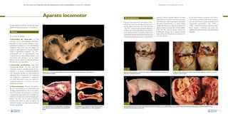 La necropsia en el ganado porcino, diagnóstico anatomopatológico y toma de muestras

Aparato locomotor

Evaluación macroscópica de vísceras

Articulaciones
El grupo más importante de lesiones articulares en el cerdo son las inflamaciones (artritis). Se utiliza el término de artritis fibrinosa
–Fig. 197– cuando existe exudado inflamatorio fibrinoso o fibrino-purulento en el interior
de la cápsula articular y se asocia a infecciones
bacterianas septicémicas (especialmente en la
infección por Streptococcus suis y Haemophilus

En esta sección se dividen las lesiones según
afecten al hueso, articulación o musculatura.

Hueso
En el hueso se destaca:

parasuis). Dado el carácter sistémico de estas
infecciones, es muy frecuente observar poliartritis fibrinosa o fibrino-purulenta (afectación
de varias articulaciones) y, a veces, incluso
poliserositis fibrinosa o fibrino-purulenta). En
algunos casos se pueden dar artritis proliferativas –Fig. 198–, que son formas crónicas con
proliferación fibrosa de la cápsula articular.
Estas últimas son frecuentes en la forma crónica del mal rojo.

En los casos donde se produce una inflamación crónica, también suele existir participación de estructuras situadas alrededor de la
articulación (periartritis, –Figs. 199A y
199B–), membrana sinovial (sinovitis), membrana sinovial y tendones que pasan por
aquella zona (tenosinovitis), y bolsas sinoviales
(bursitis).

•

Anomalías del desarrollo. La más
conocida es la condrodisplasia, fenómeno
asociado a la raza Landrace danesa, y caracterizada por enanismo, con las extremidades
delanteras más cortas que las traseras. Se
asocia a un gen autosómico recesivo.También
existe la hiperostosis congénita –Fig. 194–,
caracterizada por un engrosamiento muy
marcado de las extremidades, debido a un
crecimiento del periostio y de los tejidos
blandos que lo rodean. Se trata de procesos
de aparición muy esporádica.

•

Anomalías metabólicas. Caso de la
osteodistrofia fibrosa –Fig. 195–, que habitualmente se da en animales jóvenes en crecimiento, y se asocia a hiperparatiroidismo
(con frecuencia también es concomitante la
deficiencia de la vitamina D). Se caracteriza
por reabsorción osteoclástica y sustitución
por tejido fibro-óseo. Cursa con malformaciones de huesos. Es un proceso muy poco
habitual en el cerdo.

Fig. 194

Fig. 197

Engrosamiento de las extremidades debido al crecimiento del periostio y tejidos blandos que lo rodean (flechas)
en la hiperostosis congénita.

Presencia de fibrina (flechas) en el interior de la cápsula articular (artritis fibrinosa) asociada a una
infección por Streptococcus suis tipo 2.

A

Fig. 198
Proliferación fibrosa (flechas) de la cápsula articular (artritis proliferativa crónica) en un caso de
mal rojo en su forma crónica.

B

•

Osteocondrosis. Proceso caracterizado por anormalidad en el crecimiento del
cartílago, especialmente en las zonas epifisarias. En los casos más avanzados se produce
la separación de la epífisis de la metáfisis, utilizándose en este caso la terminología epifisiolisis –Fig. 196–. En el cerdo, el proceso
ancóneo del cúbito no tiene un centro de
osificación propio y, en este caso, se utiliza el
término apofisiolisis.

Fig. 195
Incremento del tamaño de la cabeza debido a la proliferación
de un tejido fibro-óseo (muestra fijada) en la osteodistrofia
fibrosa.

112

Fig. 196
Anormalidad en el crecimiento con separación de la epífisis
respecto a la metáfisis (flecha) en un fémur (epifisiolisis).

Fig. 199
Marcado abultamiento de la articulación fémorotibiorotuliana en la extremidad posterior derecha debido a una periartritis crónica (A). Presencia de material fibroso y necrótico alrededor de una
articulación (periartritis fibrosa crónica) (B).
113

 