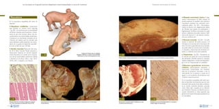 La necropsia en el ganado porcino, diagnóstico anatomopatológico y toma de muestras

Evaluación macroscópica de vísceras

• Miopatía nutricional y tóxica. El diag-

Musculatura

nóstico macroscópico es difícil, aunque se
puede sospechar en aquellos casos donde la
musculatura presenta una coloración anormalmente pálida –Fig. 203–. Microscópicamente se observa una degeneración hialina
de Zencker, que supone una hialinización y
fragmentación de fibras musculares. Se suele
asociar a deficiencia de poder reductor (deficiencia de vitamina E y de selenio), intoxicación por ionóforos, etc.

En la musculatura esquelética del cerdo se
describe:

•

Hipoplasia miofibrilar. Usualmente
este proceso se conoce como splay-leg
–Fig. 200–; se caracteriza por la imposibilidad
del lechón neonato para levantarse y mantenerse en pie. Este proceso afecta más frecuentemente a las extremidades posteriores.
Consiste en un crecimiento retrasado de los
músculos, de manera que los animales que
nacen afectados suelen presentar una musculatura con un grado de desarrollo equivalente al de un feto de unos 100 días.

•

Necrosis muscular –Fig. 204–. Se suele
asociar al síndrome de estrés porcino, y el
más típico es la necrosis de la musculatura del
lomo. De forma generalmente focal también
se puede observar necrosis de la musculatura, asociada a inyecciones de productos irritantes o a infección de la zona inyectada.

•

Atrofia muscular. Reducción del tamaño de la fibra muscular. Puede asociarse a
denervación (lesiones en nervios; especialmente frecuente es la atrofia de la musculatura de las extremidades posteriores debida
a lesiones en el nervio ciático –Figs. 201A,
201B y 202–), caquexia y por desuso.

Fig. 200

Lechones de 3 días de vida con “splay-leg”
(hipoplasia miofibrilar), con afección de extremidades
anteriores en un caso y de las posteriores en otro.

•

Fig. 203
Palidez muscular marcada, especialmente en la musculatura de la parte superior, en un caso de miopatía de origen nutricional.

Triquinelosis –Fig. 205–. Parasitación en
el músculo por parte de la larva enquistada
del nematodo Trichinella spiralis. Es necesario
realizar el diagnóstico a través de histopatología o con un triquinoscopio en matadero.

• Abscesos y granulomas en la mus-

A

culatura, generalmente asociados a
inyecciones contaminadas con bacterias
(sea por el producto inoculado o por la
vehiculación de la bacteria a través de la
aguja) o a la inoculación de productos muy
irritantes, respectivamente.
En la musculatura esquelética del cerdo también se describen otras lesiones que son relativamente infrecuentes. Entre ellas se destacaría la miositis clostridial (también conocida
como “black leg”), causada por la infección
por Clostridium chauvoei, y la infección por Sarcocystis miescheriana (y otras especies), que
genera la formación de quistes parasitarios en
la musculatura.

B

Fig. 201
Marcada atrofia de la musculatura estriada (A) comparada
con la de la extremidad contralateral (B).Tinción de HE.
114

Fig. 202
Causa primaria de una atrofia por denervación; compresión del nervio ciático (izquierda) en comparación con un nervio ciático
normal (derecha).

Fig. 204
Necrosis de la musculatura del lomo (flecha) en un caso
de síndrome de estrés porcino.

Fig. 205
Presencia de una larva deTrichinella spiralis en la musculatura
estriada. Imagen de triquinoscopio.
115

 
