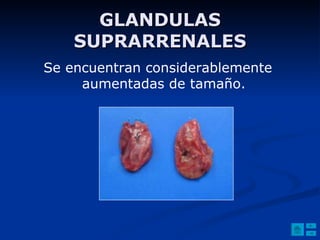 GLANDULAS SUPRARRENALES Se encuentran considerablemente aumentadas de tamaño. 