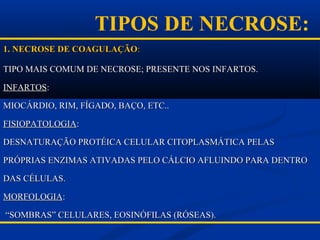 1. NECROSE DE COAGULAÇÃO1. NECROSE DE COAGULAÇÃO::
TIPO MAIS COMUM DE NECROSE; PRESENTE NOS INFARTOS.TIPO MAIS COMUM DE NECROSE; PRESENTE NOS INFARTOS.
INFARTOSINFARTOS::
MIOCÁRDIO, RIM, FÍGADO, BAÇO, ETC..MIOCÁRDIO, RIM, FÍGADO, BAÇO, ETC..
FISIOPATOLOGIAFISIOPATOLOGIA::
DESNATURAÇÃO PROTÉICA CELULAR CITOPLASMÁTICA PELASDESNATURAÇÃO PROTÉICA CELULAR CITOPLASMÁTICA PELAS
PRÓPRIAS ENZIMAS ATIVADAS PELO CÁLCIO AFLUINDO PARA DENTROPRÓPRIAS ENZIMAS ATIVADAS PELO CÁLCIO AFLUINDO PARA DENTRO
DAS CÉLULAS.DAS CÉLULAS.
MORFOLOGIAMORFOLOGIA::
““SOMBRAS” CELULARES, EOSINÓFILAS (RÓSEAS).SOMBRAS” CELULARES, EOSINÓFILAS (RÓSEAS).
TIPOS DE NECROSE:
 