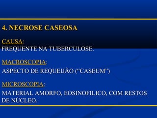 4. NECROSE CASEOSA4. NECROSE CASEOSA
CAUSACAUSA::
FREQUENTE NA TUBERCULOSE.FREQUENTE NA TUBERCULOSE.
MACROSCOPIAMACROSCOPIA::
ASPECTO DE REQUEIJÃO (“CASEUM”)ASPECTO DE REQUEIJÃO (“CASEUM”)
MICROSCOPIAMICROSCOPIA::
MATERIAL AMORFO, EOSINOFILICO, COM RESTOSMATERIAL AMORFO, EOSINOFILICO, COM RESTOS
DE NÚCLEO.DE NÚCLEO.
 
