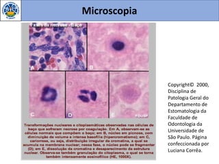 Microscopia
Copyright© 2000,
Disciplina de
Patologia Geral do
Departamento de
Estomatologia da
Faculdade de
Odontologia da
Universidade de
São Paulo. Página
confeccionada por
Luciana Corrêa.
 