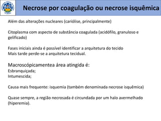 Necrose por coagulação ou necrose isquêmica
Além das alterações nucleares (cariólise, principalmente)
Citoplasma com aspecto de substância coagulada (acidófilo, granuloso e
gelificado)
Fases iniciais ainda é possível identificar a arquitetura do tecido
Mais tarde perde-se a arquitetura tecidual.
Macroscópicamentea área atingida é:
Esbranquiçada;
Intumescida;
Causa mais frequente: isquemia (também denominada necrose isquêmica)
Quase sempre, a região necrosada é circundada por um halo avermelhado
(hiperemia).
 