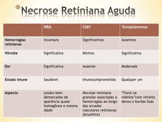 *
               NRA                 CMV                     Toxoplasmose


Hemorragias    Incomuns            Significativas          Ausentes
retinianas

Vitreíte       Significativa       Mínima                  Significativa


Dor            Significativa       Ausente                 Moderada


Estado imune   Saudável            Imunocomprometido       Qualquer um


Aspecto        Lesões bem          Necrose retiniana       “Farol na
               demarcadas de       granular associadas a   neblina”com vitreíte
               aparência quase     hemorragias ao longo    densa e bordas lisas
               homogênea e mesma   das arcadas
               idade               vasculares retinianas
                                   (brushfire)
 