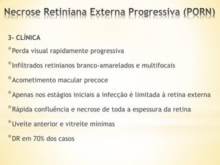 3- CLÍNICA
* Perda visual rapidamente progressiva
* Infiltrados retinianos branco-amarelados e multifocais
* Acometimento macular precoce
* Apenas nos estágios iniciais a infecção é limitada à retina externa
* Rápida confluência e necrose de toda a espessura da retina
* Uveíte anterior e vitreíte mínimas
* DR em 70% dos casos
 