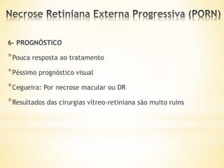 6- PROGNÓSTICO

* Pouca resposta ao tratamento
* Péssimo prognóstico visual
* Cegueira: Por necrose macular ou DR
* Resultados das cirurgias vítreo-retiniana são muito ruins
 