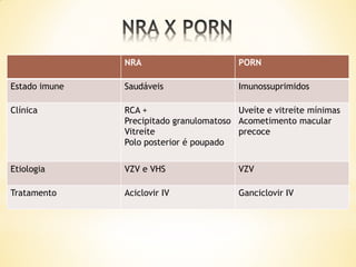 NRA                       PORN

Estado imune   Saudáveis                 Imunossuprimidos

Clínica        RCA +                     Uveíte e vitreíte mínimas
               Precipitado granulomatoso Acometimento macular
               Vitreíte                  precoce
               Polo posterior é poupado


Etiologia      VZV e VHS                 VZV

Tratamento     Aciclovir IV              Ganciclovir IV
 