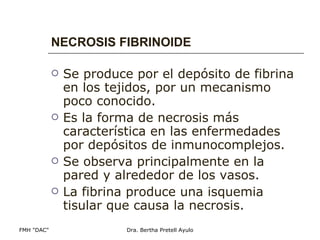 NECROSIS FIBRINOIDE Se produce por el depósito de fibrina en los tejidos, por un mecanismo poco conocido. Es la forma de necrosis más característica en las enfermedades por depósitos de inmunocomplejos. Se observa principalmente en la pared y alrededor de los vasos. La fibrina produce una isquemia tisular que causa la necrosis. 