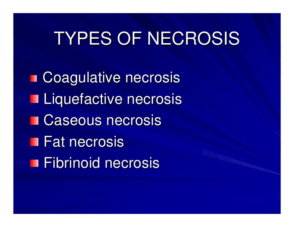 Necrosis