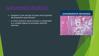 GANGRENOUS NECROSIS
 Gangrene is the necrosis of tissue with enzymatic
decomposition (putrefaction)
 In which extensive tissue necrosis is complicated
to a variable degree by secondary bacterial
infection.
 