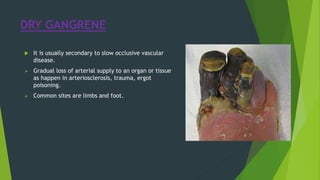 DRY GANGRENE
 It is usually secondary to slow occlusive vascular
disease.
 Gradual loss of arterial supply to an organ or tissue
as happen in arteriosclerosis, trauma, ergot
poisoning.
 Common sites are limbs and foot.
 