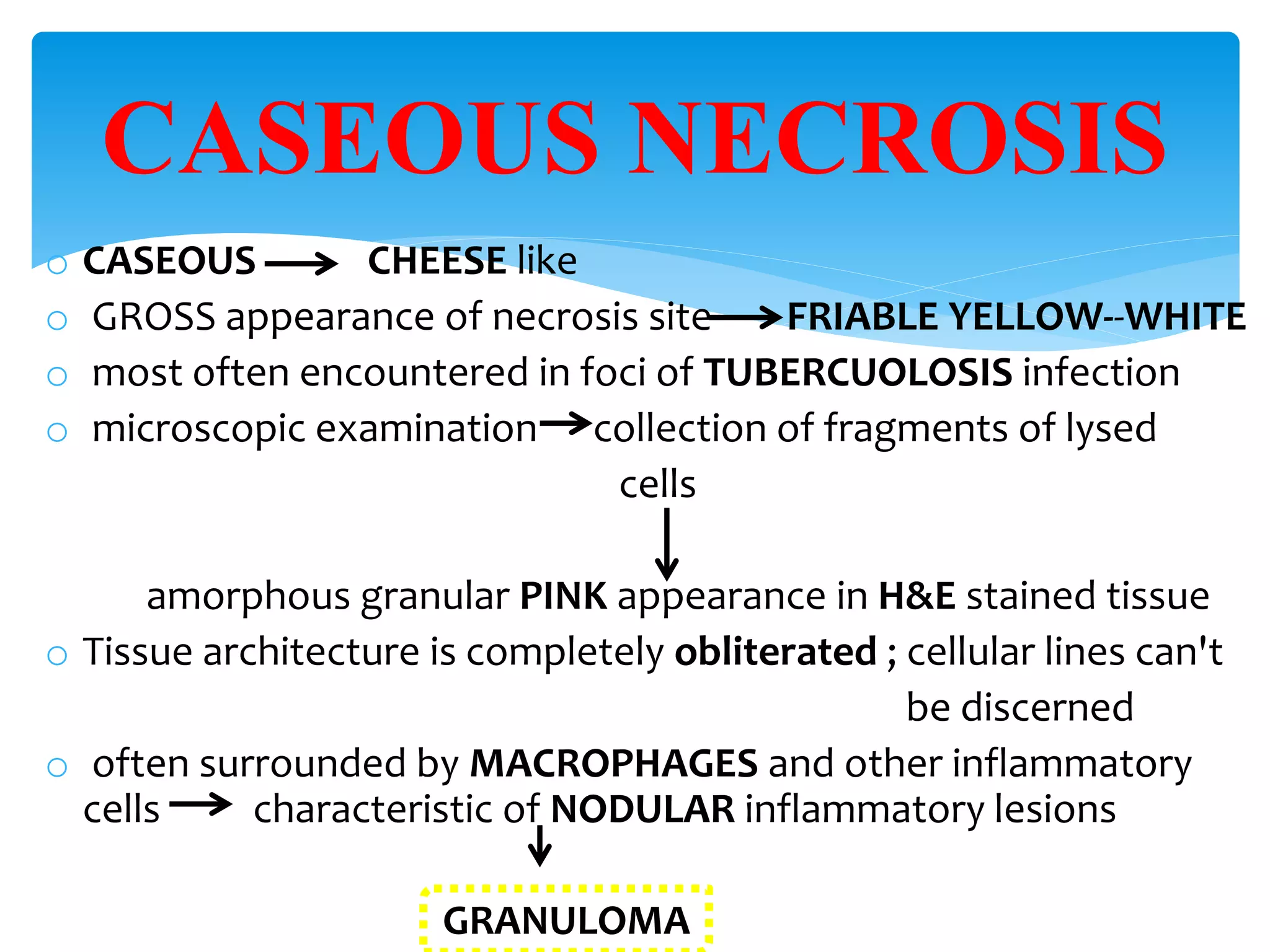 o CASEOUS CHEESE like
o GROSS appearance of necrosis site FRIABLE YELLOW--WHITE
o most often encountered in foci of TUBERCUOLOSIS infection
o microscopic examination collection of fragments of lysed
cells
amorphous granular PINK appearance in H&E stained tissue
o Tissue architecture is completely obliterated ; cellular lines can't
be discerned
o often surrounded by MACROPHAGES and other inflammatory
cells characteristic of NODULAR inflammatory lesions
GRANULOMA
CASEOUS NECROSIS
 