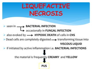  seen in BACTERIAL INFECTION
occasionally in FUNGAL INFECTION
 also evoked by HYPOXIC DEATH of cells in CNS
Dead cells are completely digested transforming tissue into
VISCOUS LIQUID
 if initiated by active inflammation i.e. BACTERIAL INFECTIONS
the material is frequently CREAMY and YELLOW
PUS
LIQUEFACTIVE
NECROSIS
 