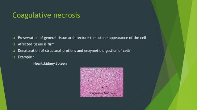 Necrosis and apoptosis | PPTX